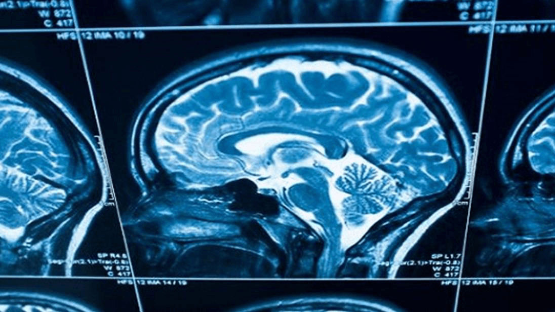 The Neurology Channel — Brain and nervous system health.